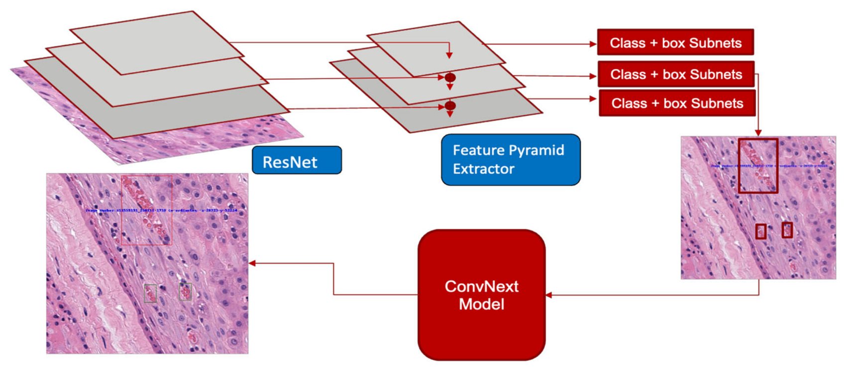 Figure 7A of the paper: the hierarchical pipeline — a ResNet backbone and feature pyramid propose vessels, then a ConvNext model classifies each one